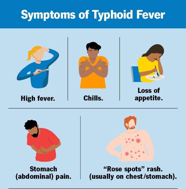 Typhoid Fever